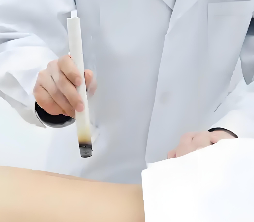 Why Does Moxibustion Cause “Internal Heat”?